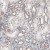 Immunohistochemistry-Paraffin: ABCD4 Antibody [NBP1-83954] Immunohistochemical staining of human kidney shows moderate cytoplasmic positivity in cells in tubules.